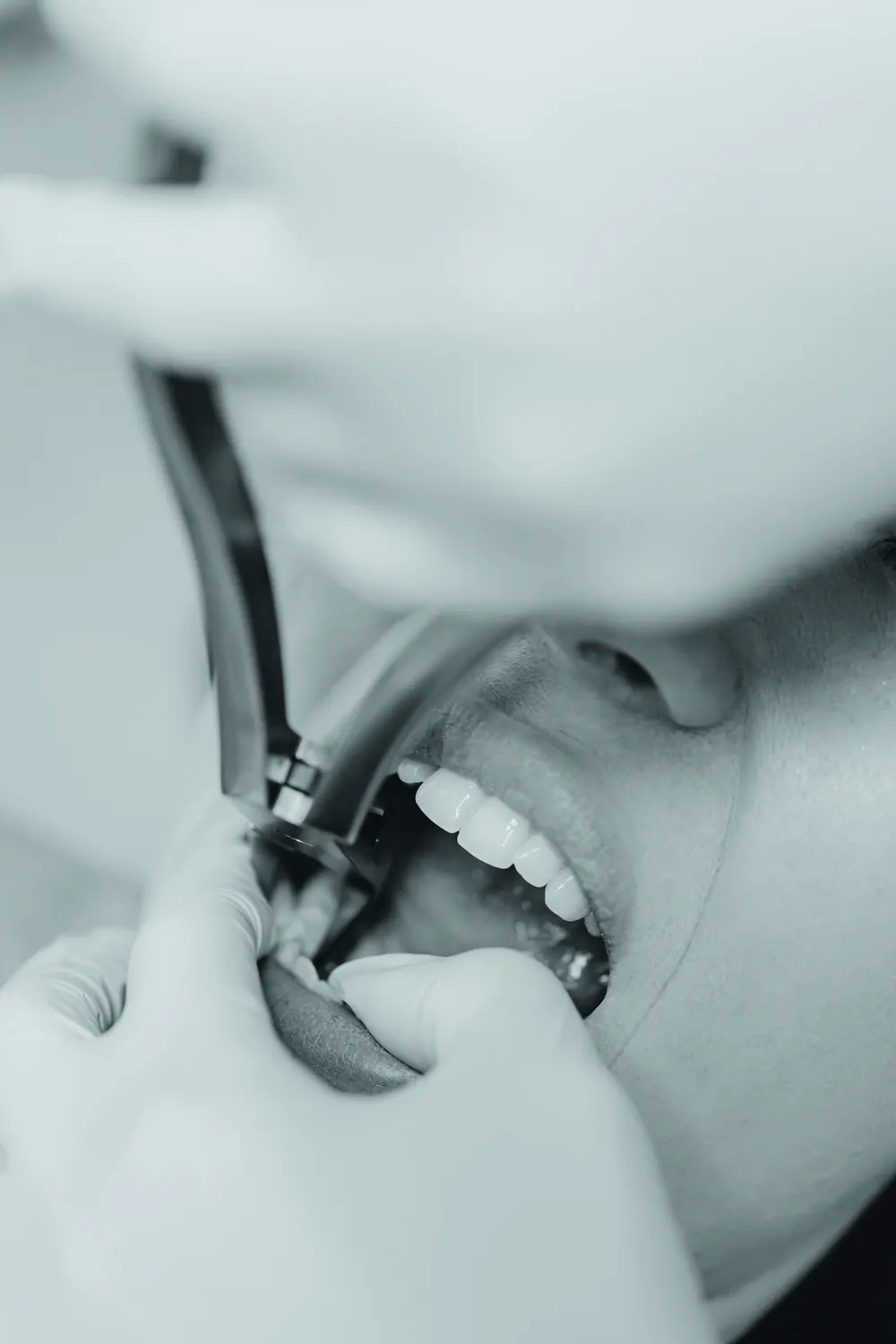 Limpieza dental en consultorio